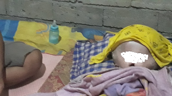 Bayi Pengidap Hydrocephalus di Sausu Tambu Parimo Butuh Bantuan